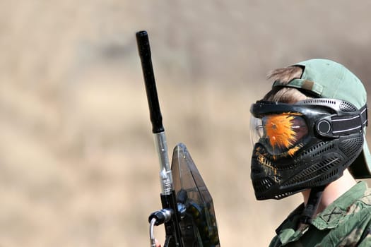 paintball - teen shot in face