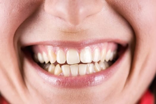 Laughing woman's mouth