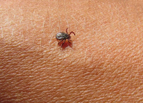 Tick on the skin