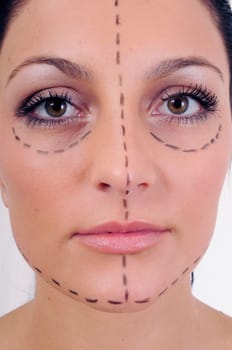 Woman before cosmetic surgery