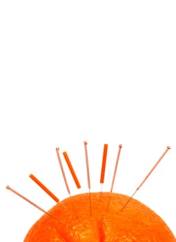 Acupuncture