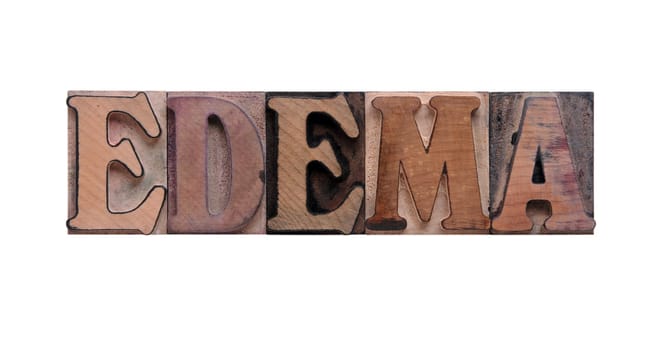 edema in old ink-stained wood type