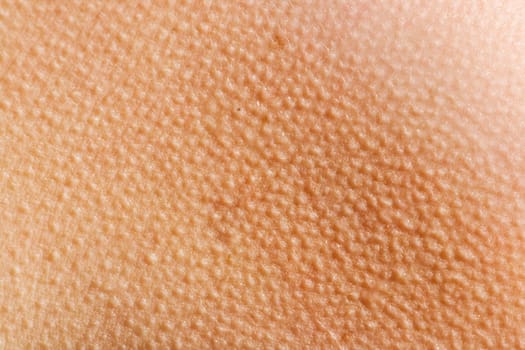 Goosebumps Skin Background
