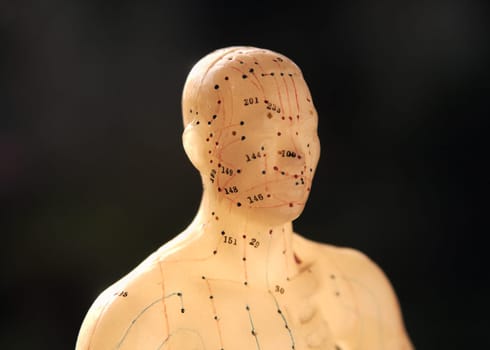 acupuncture figure