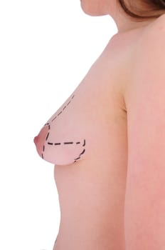 female breast before plastic surgery