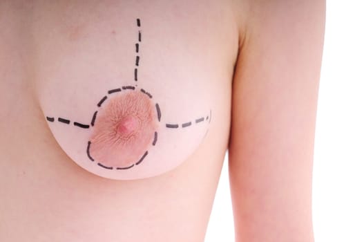 female breast before plastic surgery