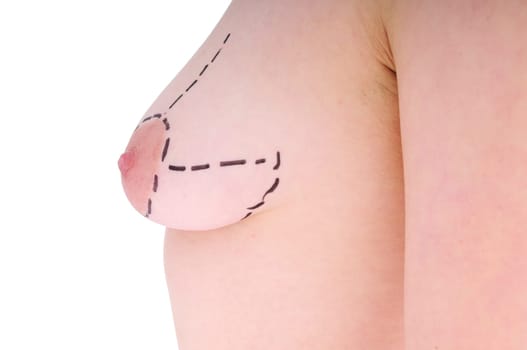 female breast before plastic surgery