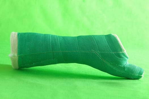 A removed cast