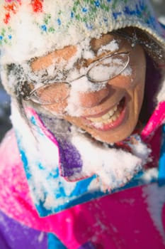 Snow in the face