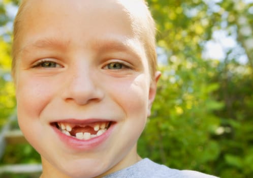 Smiling boy missing teeth