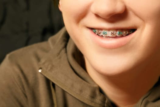 Child with braces