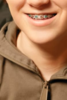 Child with braces
