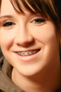 Girl with braces