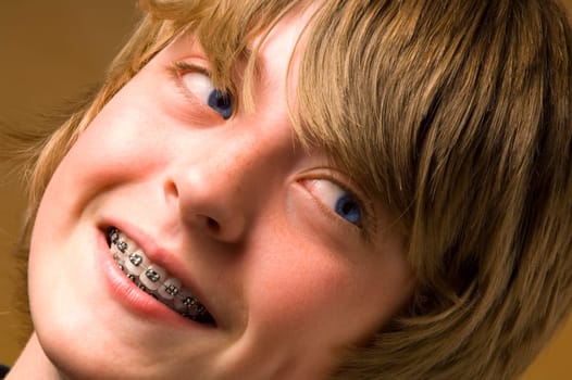 Boy with braces