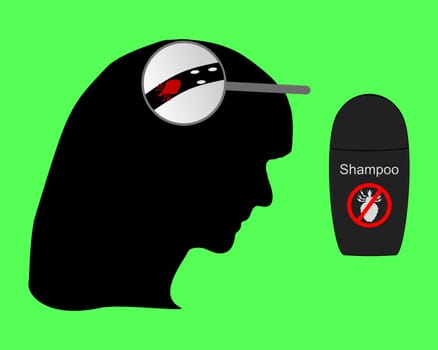 Woman's head,louse,nits and lice shampoo