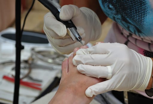 Pedicure