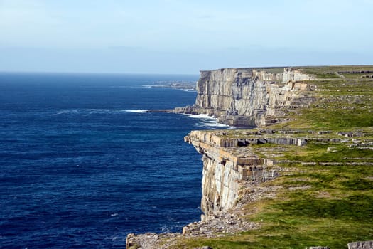 Irish Stei Coast