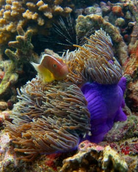 Anemone