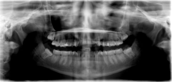 Radiograph