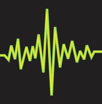 Pulse