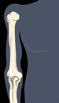 bone