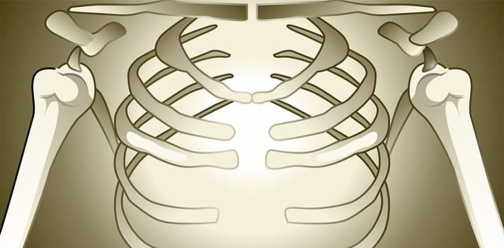 Bones
