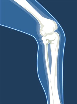 legBones