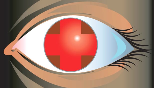 Eyeball