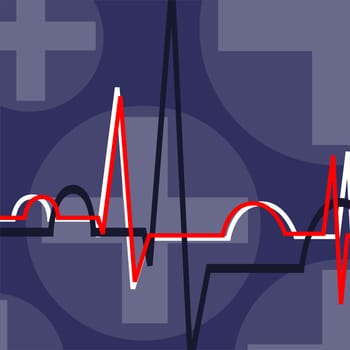 ECG