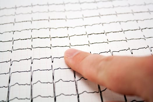 ECG graph