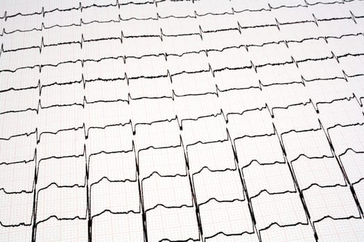 ECG - EKG graph