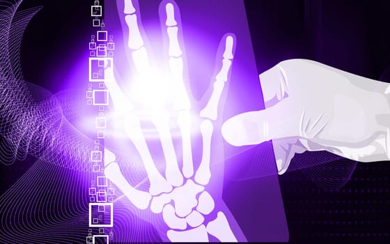 hand holding a Xray film