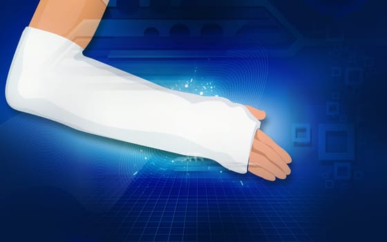 Illustration of a hand with bandages