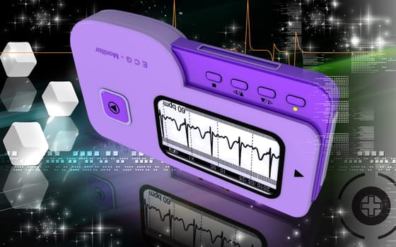 ECG