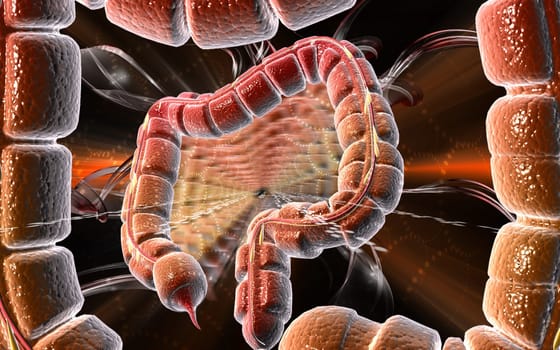 Large intestine