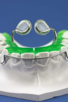 Braces