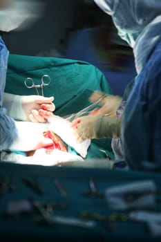 surgery operation