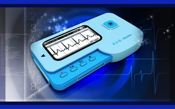 ECG