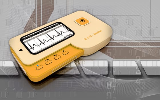 ECG