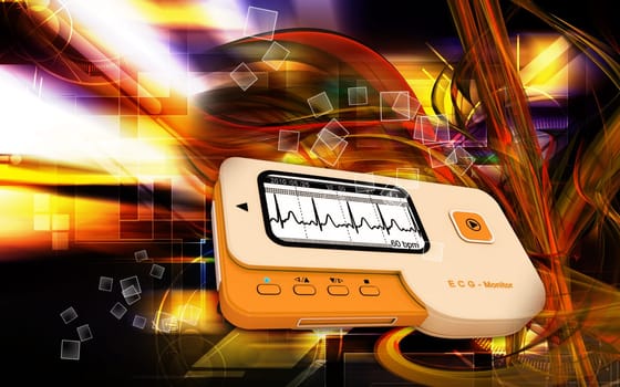 ECG