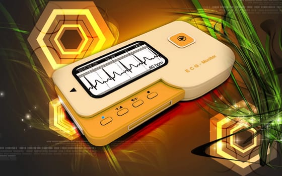 ECG