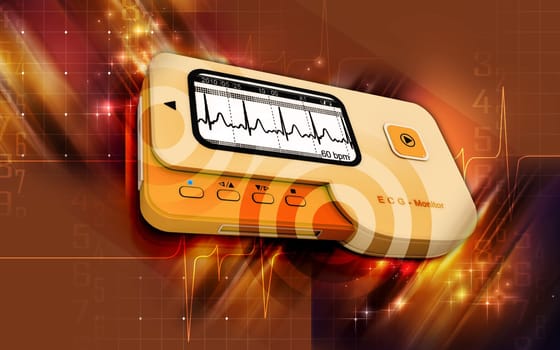 ECG