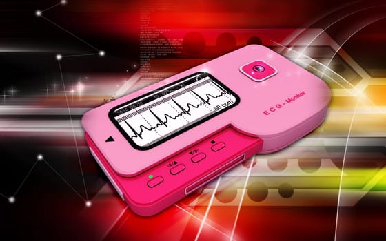 ECG