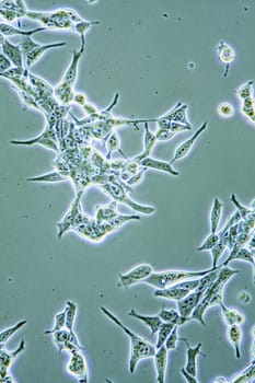 Microscope view of mens health Prostate Cancer cells in tissue culture showing walls, nucleus and organelles.