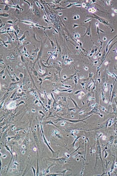 Microscope view of Muscle cells, fibroblasts and myoblasts, in tissue culture showing walls, nucleus and organelles.