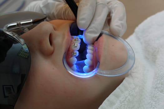 at the orthodontist
