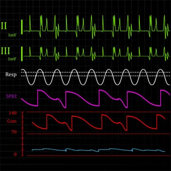 Physiologic monitor, abstract background illustration