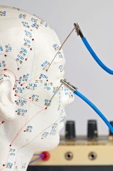 Electro-Acupuncture