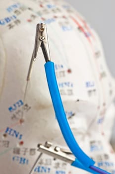 Electro-Acupuncture