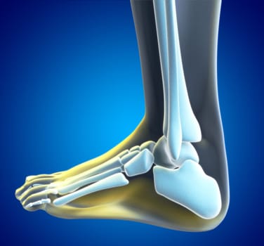 An illustration of a foot xray with a red spot showing the injured ankle.